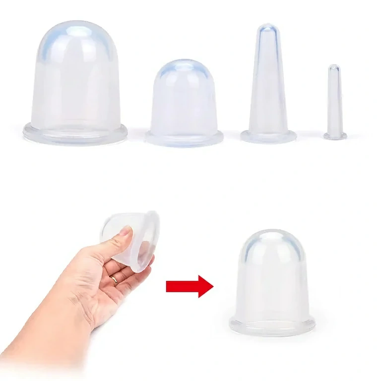 Silikoniniai ventuzai lieknėjimui ir kūno formavimui Vakuuminė terapija riebalų ir celiulito mažinimui